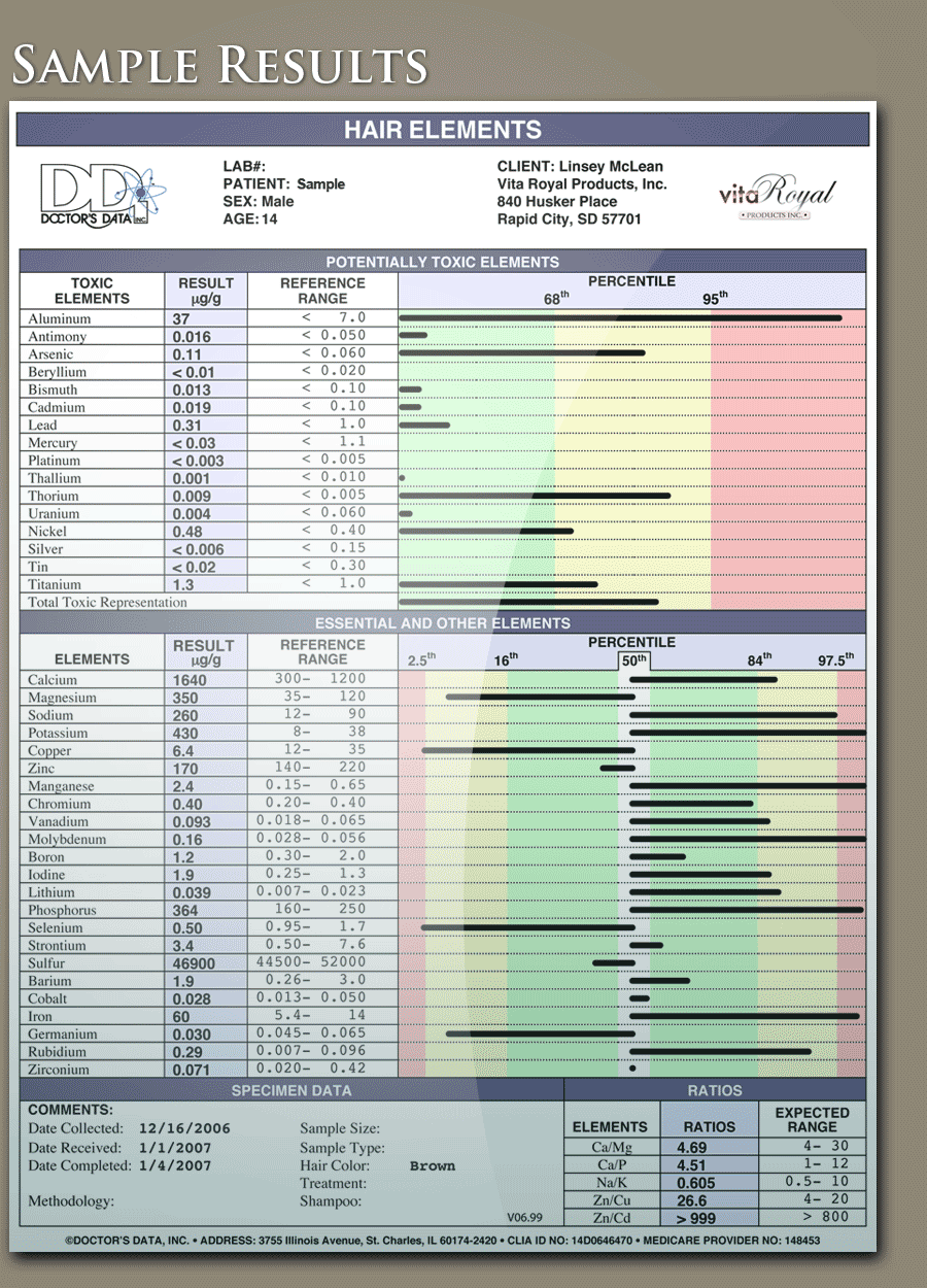 Sample Hair Analysis